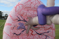 Tıbbi Sergi Etkinlikleri İçin Dev Şişme Akciğer Modeli Reklamı